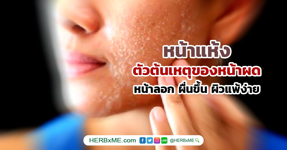 หน้าแห้ง สาเหตุ Dry Skin Face